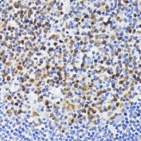 NFAT2 Rabbit polyclonal antibody