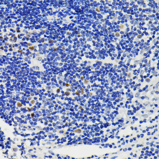 NFAT2 Rabbit polyclonal antibody