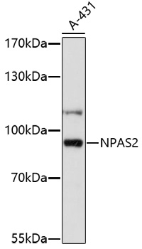 NPAS2 Rabbit polyclonal antibody