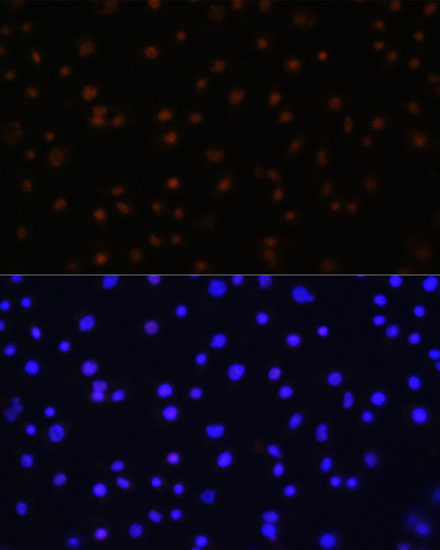 NPAS2 Rabbit polyclonal antibody