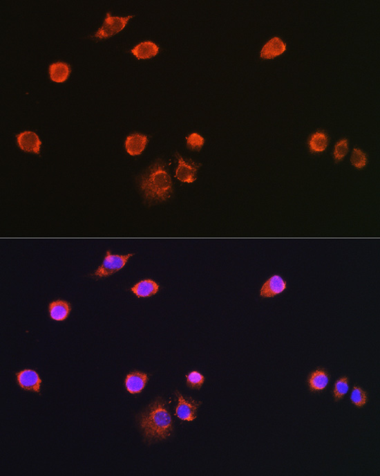 NPR3 Rabbit polyclonal antibody
