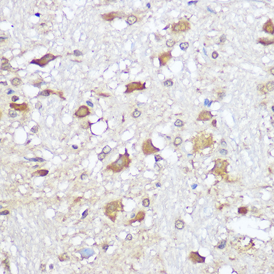 Mu Opioid Receptor(MOR) Rabbit polyclonal antibody