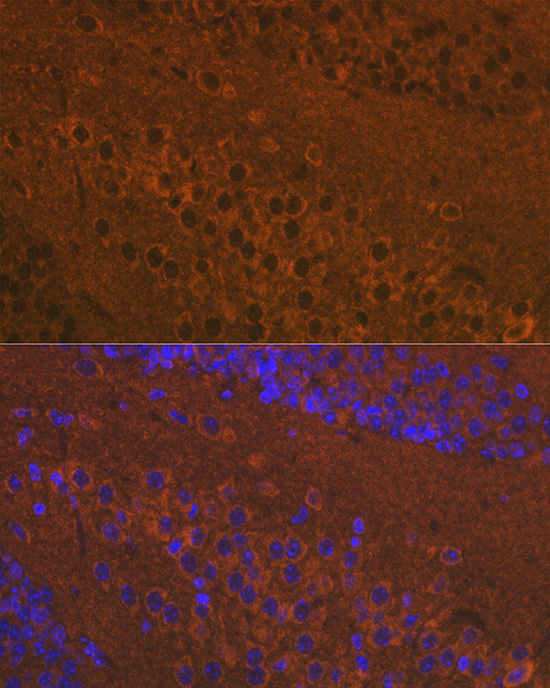 Mu Opioid Receptor(MOR) Rabbit polyclonal antibody