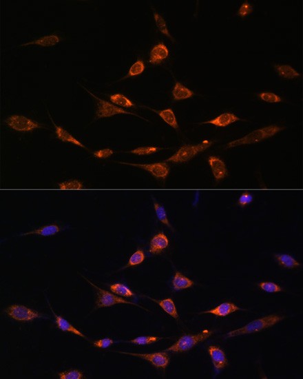 PAK3 Rabbit polyclonal antibody