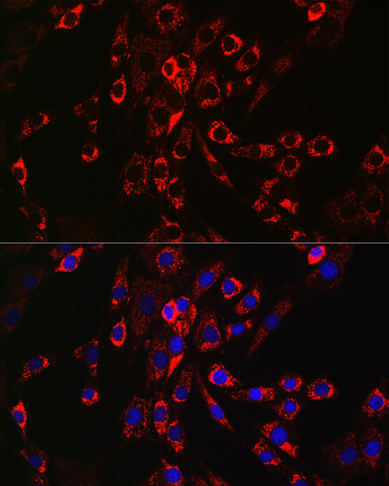 HB-EGF Rabbit polyclonal antibody