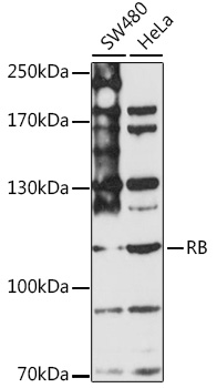 RB Rabbit polyclonal antibody