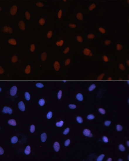RB Rabbit polyclonal antibody