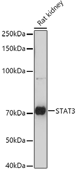STAT3 Rabbit polyclonal antibody
