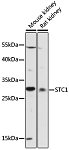 Western blot - STC1 Rabbit pAb (A16976)