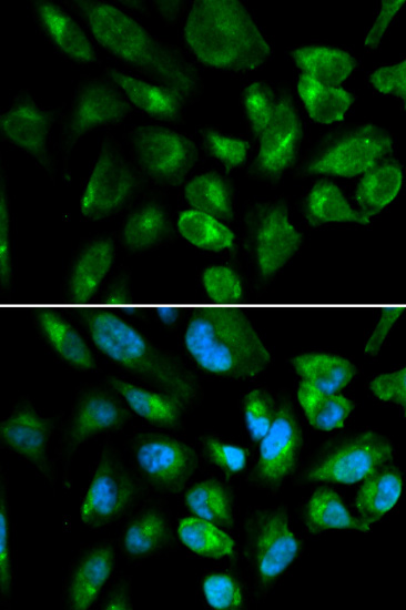 KIR2DL3 Rabbit polyclonal antibody