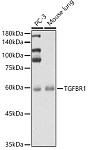 Western blot - TGF beta Receptor I (TGFBR1) Rabbit pAb (A16983)