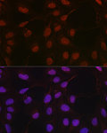 Immunofluorescence - HIF1β/ARNT Rabbit pAb (A16990)