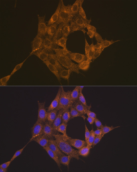 TRAF6 Rabbit polyclonal antibody