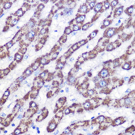 UCP3 Rabbit polyclonal antibody
