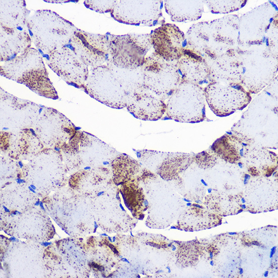 UCP3 Rabbit polyclonal antibody