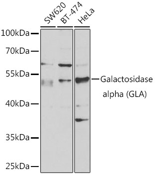 Galactosidase alpha (GLA) Rabbit polyclonal antibody