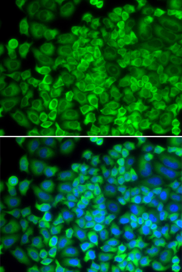 Galactosidase alpha (GLA) Rabbit polyclonal antibody