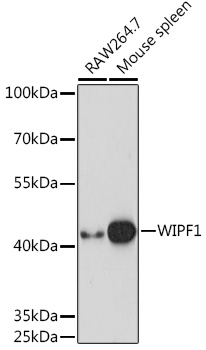 WIPF1 Rabbit polyclonal antibody