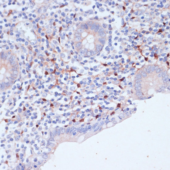 WIPF1 Rabbit polyclonal antibody