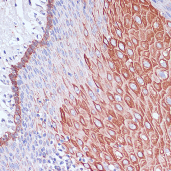 WIPF1 Rabbit polyclonal antibody