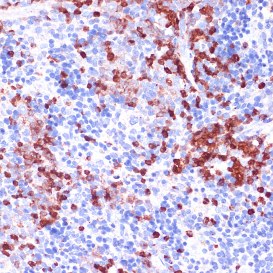 WIPF1 Rabbit polyclonal antibody