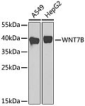 Western blot - WNT7B Rabbit pAb (A17004)