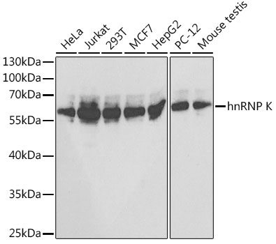 hnRNP K Rabbit polyclonal antibody