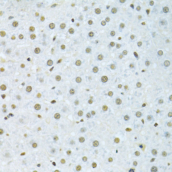 hnRNP K Rabbit polyclonal antibody