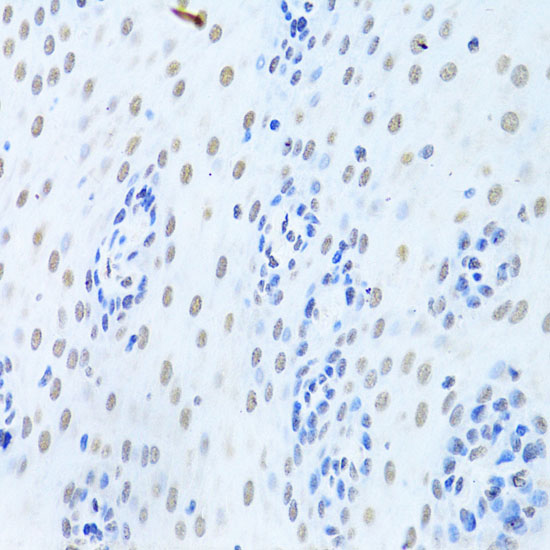 hnRNP K Rabbit polyclonal antibody