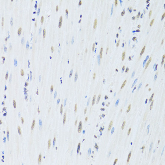 hnRNP K Rabbit polyclonal antibody