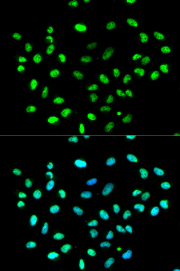 hnRNP K Rabbit polyclonal antibody