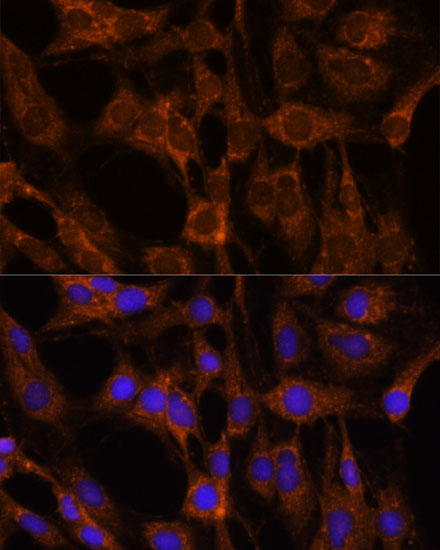BRPF1 Rabbit polyclonal antibody