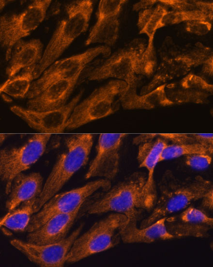 BRPF1 Rabbit polyclonal antibody