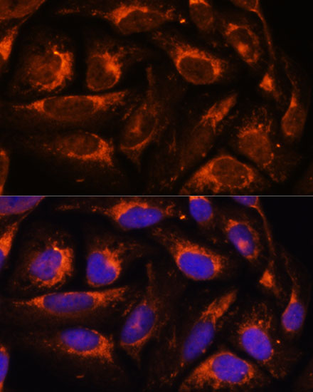 ACOX3 Rabbit polyclonal antibody