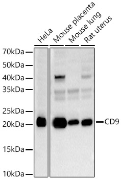 CD9 Rabbit polyclonal antibody