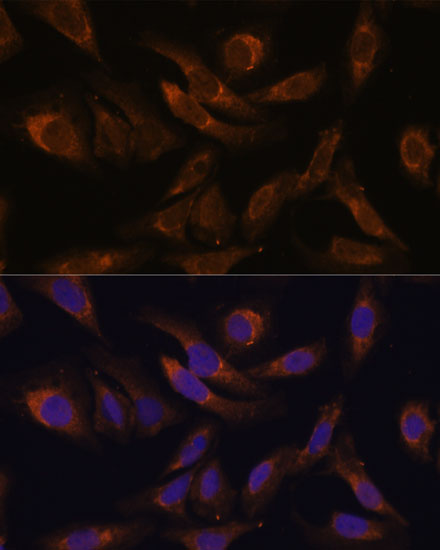 SOCS2 Rabbit polyclonal antibody