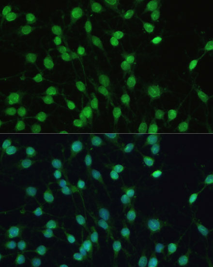 PXR Rabbit polyclonal antibody