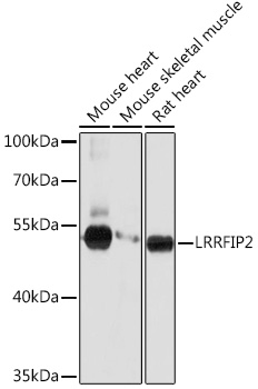 LRRFIP2 Rabbit polyclonal antibody