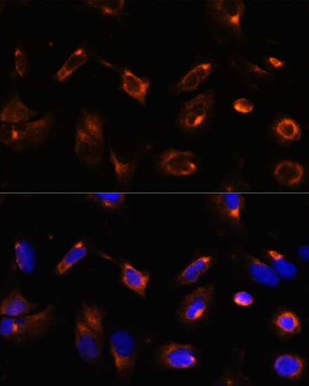 LRRFIP2 Rabbit polyclonal antibody