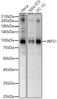 WFS1 Rabbit polyclonal antibody