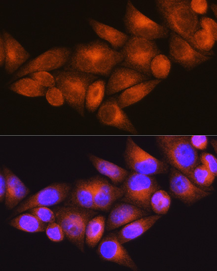 WFS1 Rabbit polyclonal antibody
