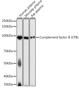 Complement factor B (CFB) Rabbit polyclonal antibody