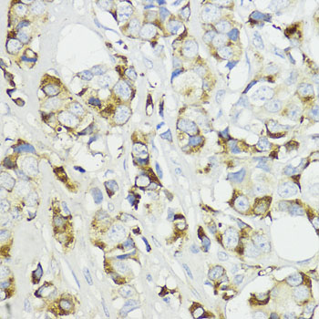 Complement factor B (CFB) Rabbit polyclonal antibody