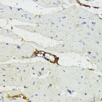Complement factor B (CFB) Rabbit polyclonal antibody