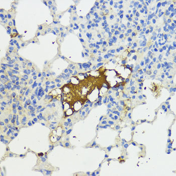 Complement factor B (CFB) Rabbit polyclonal antibody