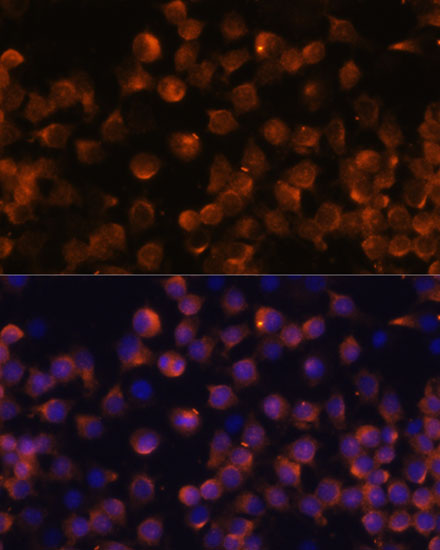 Complement factor B (CFB) Rabbit polyclonal antibody
