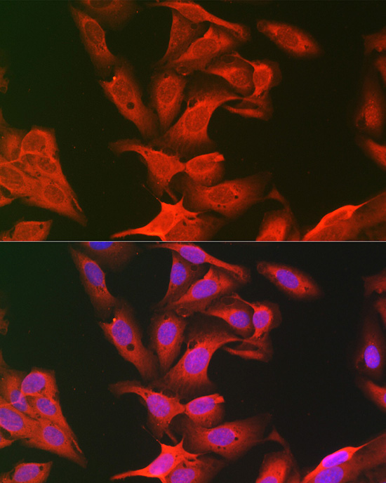 KEAP1 Rabbit polyclonal antibody