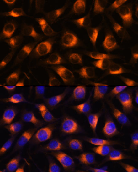 [KO Validated] VAT1 Rabbit polyclonal antibody