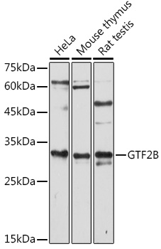 GTF2B Rabbit polyclonal antibody