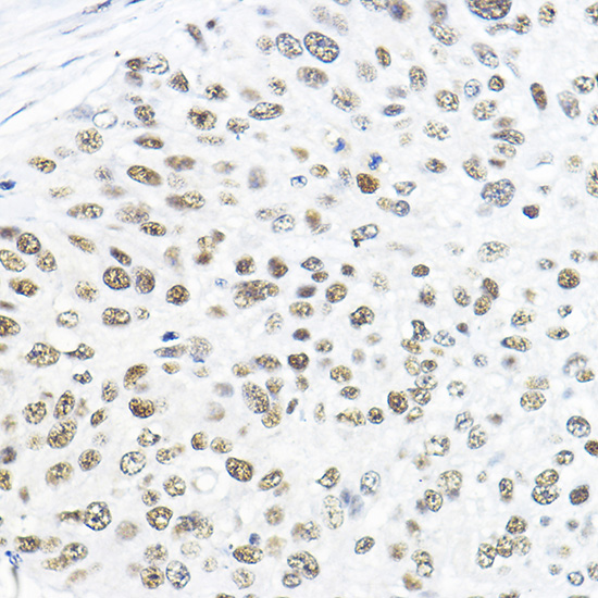 GTF2B Rabbit polyclonal antibody